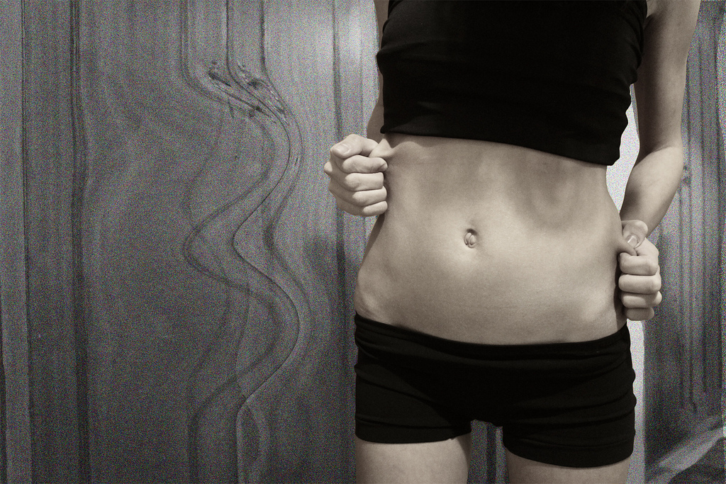 anorexia